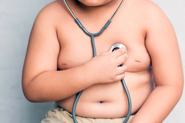Obesidade infantil: o que você precisa saber - HSF